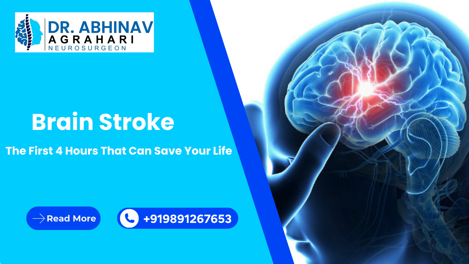 Brain Stroke: The First 4 Hours That Can Save Your Life